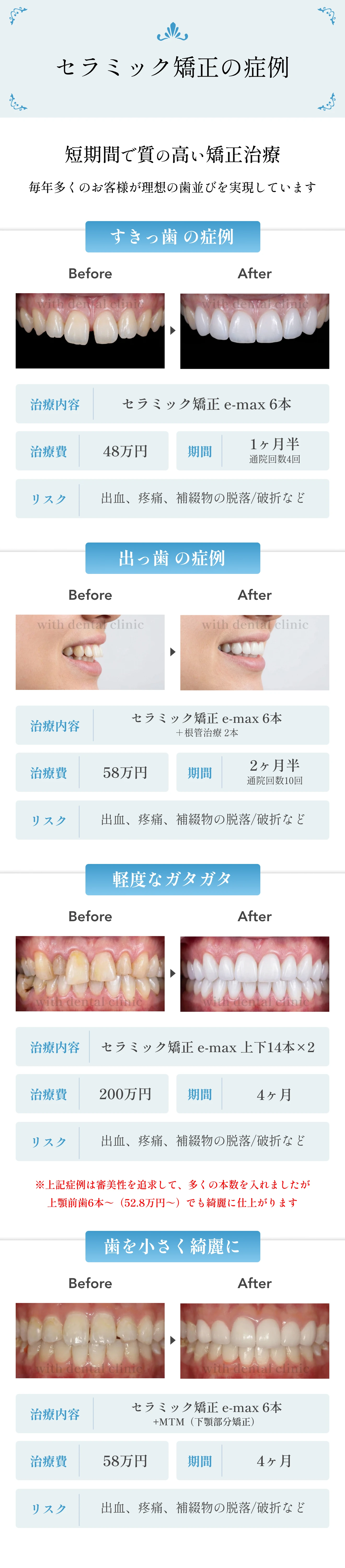 セラミック矯正の4つの症例
