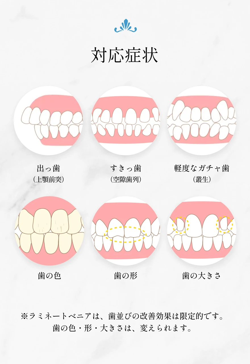 歯の色や形、大きさ、すきっ歯、出っ歯などの対応事例イラスト