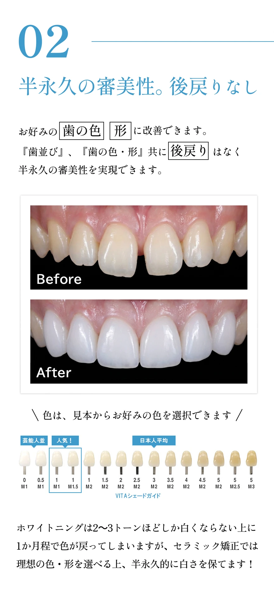 半永久的な審美性を実現する治療のビフォーアフターと、選べる歯の色見本を紹介するビジュアル