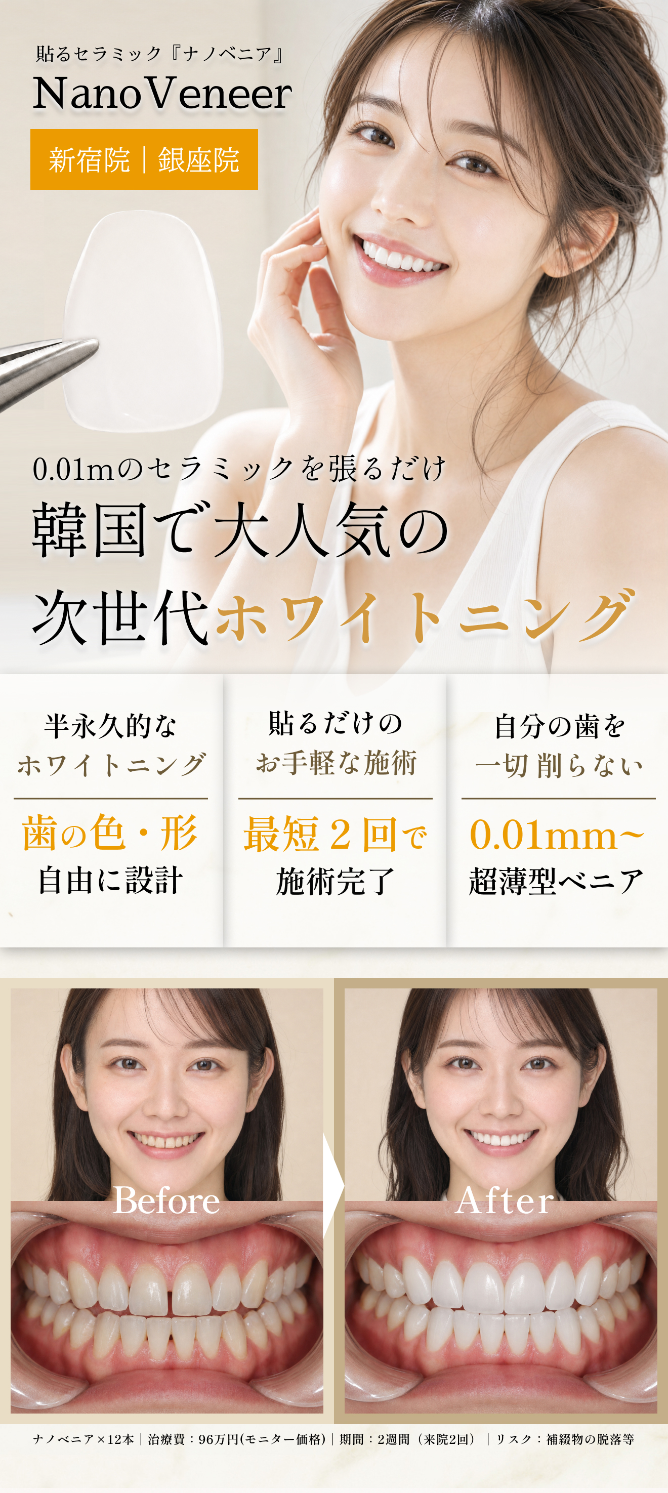 国内初導入の削らない超薄型ナノベニアと短期間でホワイトニングが完了する女性の笑顔と治療イメージビジュアル