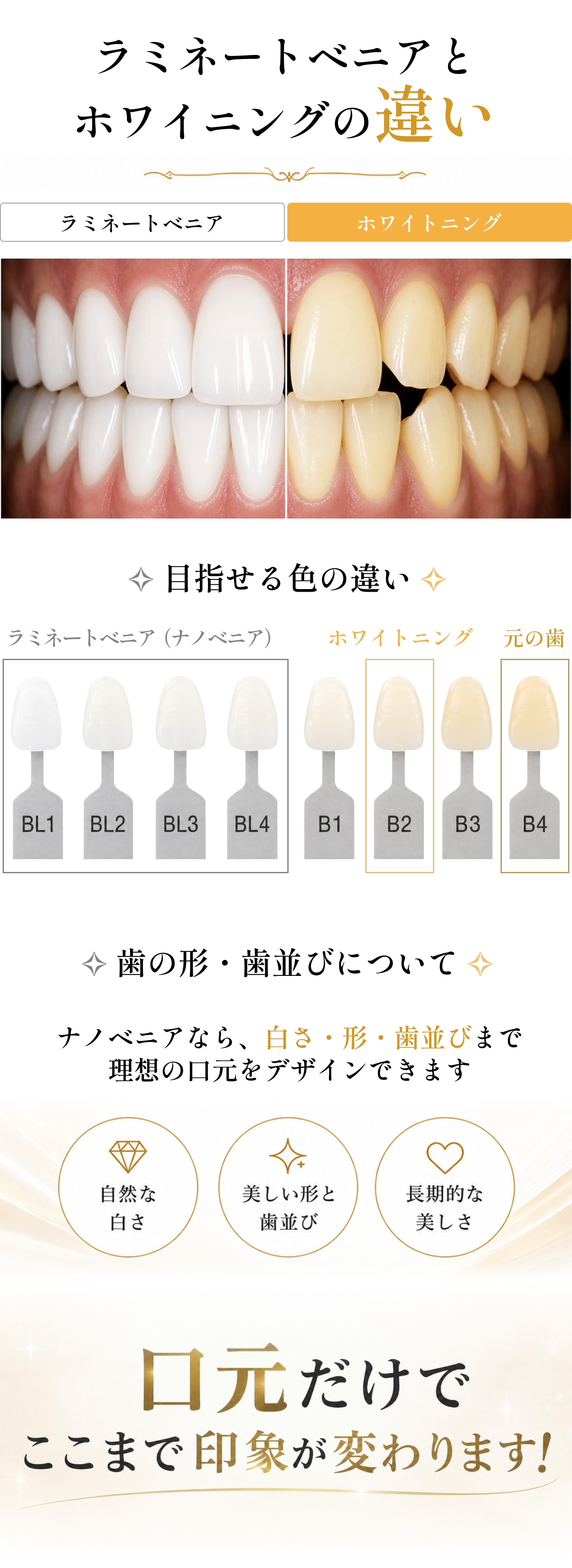 ラミネートベニアとホワイトニングの違い、目指せる白さや歯の整形の比較