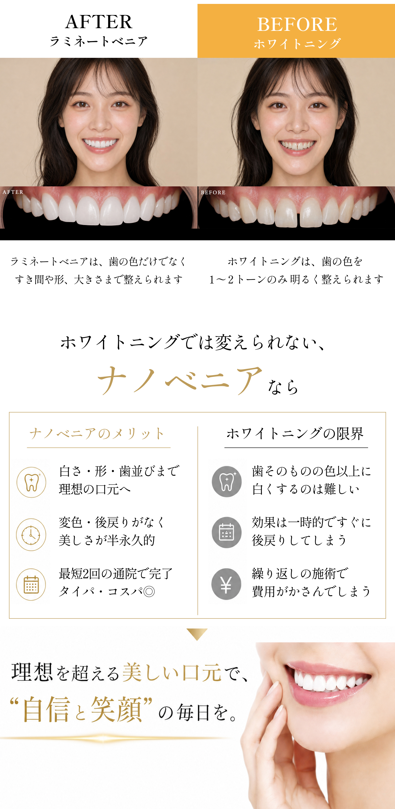 実際のビフォーアフターでの比較、ホワイトニングの効果の限界とラミネートベニアの効果