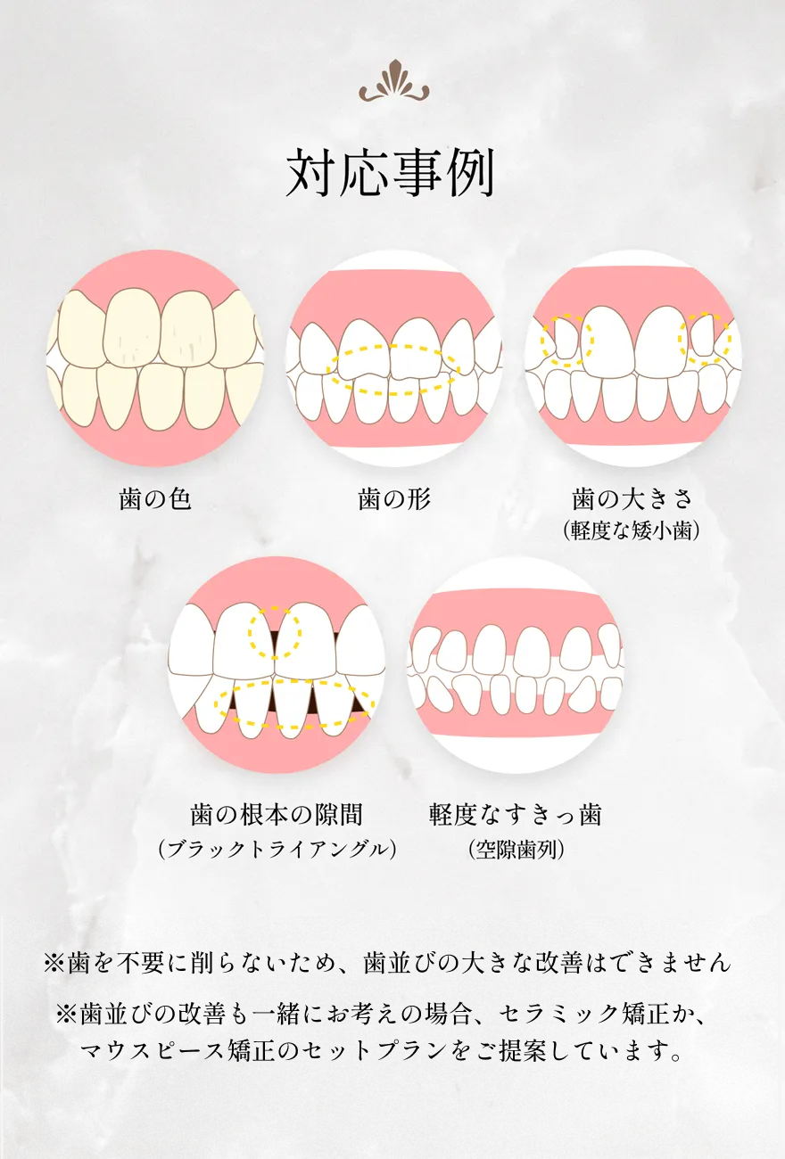 歯の色や形、大きさ、根本の隙間、すきっ歯、出っ歯などの対応事例イラスト