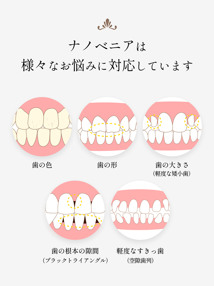 歯の色や形、大きさ、根本の隙間、すきっ歯、出っ歯などの対応事例イラスト