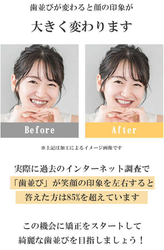 歯列矯正の前後写真