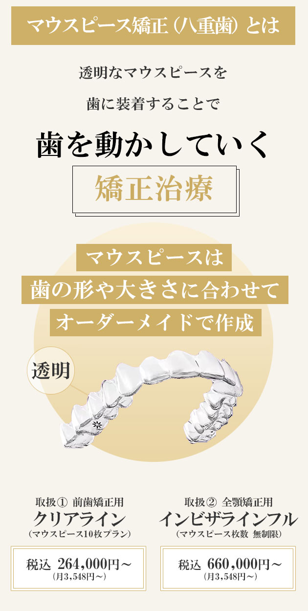 マウスピース矯正とは