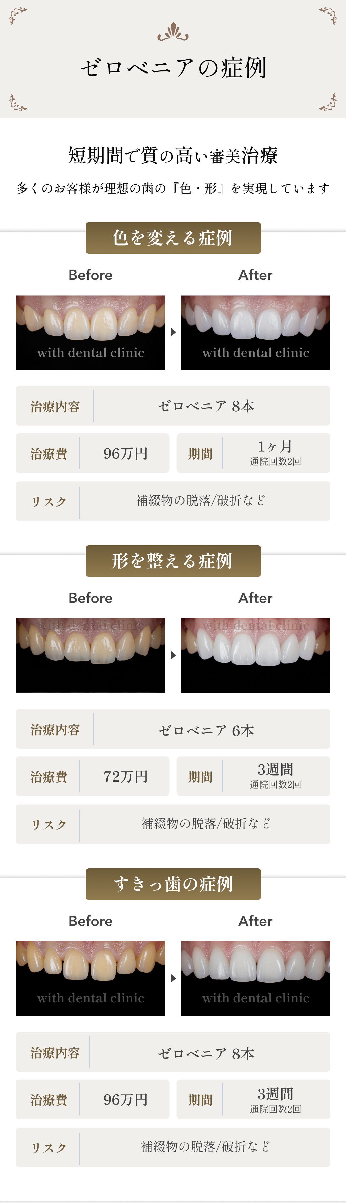 ゼロベニアの症例。歯の色、形、すきっ歯のお悩みを改善
