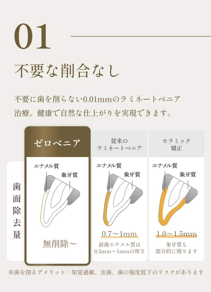 ゼロベニアは不要な歯の削合をせず、従来のラミネートベニアやセラミック矯正よりも健康的に仕上がることを示す比較図